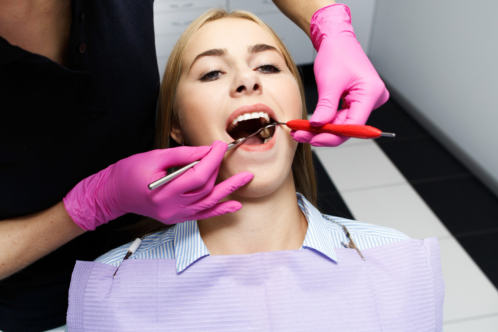 Composite Fillings